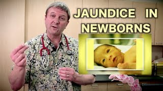 Jaundice in Newborns Pediatric Advice [upl. by Hazlett]