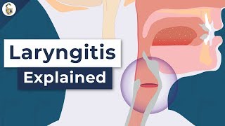 Laryngitis Home Remedies 3 Most Powerful Cures [upl. by Namie259]