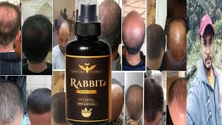 Rabbit Hair Oil  Honest Review [upl. by Siriso]