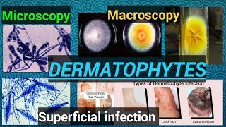 Fungal infectionFungal cultureFungal identificationDermatophytesDermatophytosisSTAR LABORATORY [upl. by Thrift]