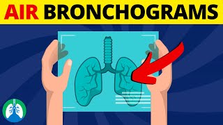 Flexible Bronchoscopy Medical Definition  Quick Overview [upl. by Emilia]