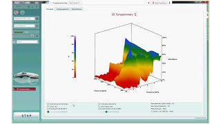 Wideband Tympanometry WBT Theory and Benefits [upl. by Allyson932]