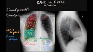 Radio du thorax  Introduction  Partie 1  Docteur Synapse [upl. by Nallid]