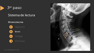 Radiografía de Columna Paso a Paso [upl. by Ginder]