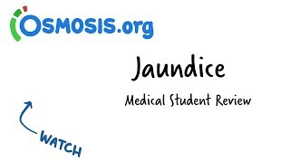 Jaundice  Clinical Presentation [upl. by Bastien]