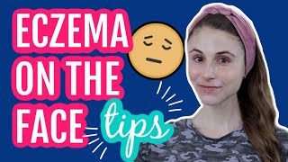 Eczema on the face 11 tips from a dermatologist Dr Dray [upl. by Lesak966]