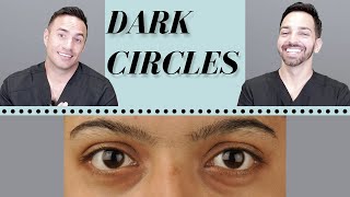 Dark Circles Causes amp Treatments  Dermatologist Perspective [upl. by Edris764]