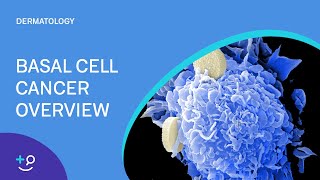 Basal Cell Cancer Overview Dermatology [upl. by Whale]