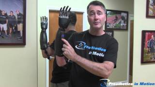 Below The Elbow Amputee Demonstrates BeBionic 3 Myoelectric Prosthesis [upl. by Isoais425]