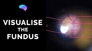 Fundoscopy  How to Visualise the Fundus  Direct Ophthalmoscopy  OSCE Guide  UKMLA  CPSA [upl. by Philbin]