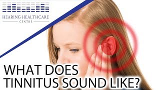 What Does Tinnitus Sound Like [upl. by Lombardy]