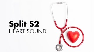 Fixed Split S2  Heart Sounds  MEDZCOOL [upl. by Matuag]