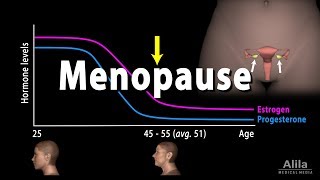 How I Treated My Atrophy On Testosterone [upl. by Mat]