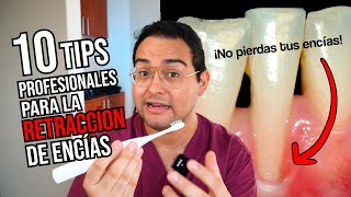 10 TIPS PROFESIONALES para DETENER y PREVENIR las ENCÍAS RETRAÍDAS  ¡NO PIERDAS TUS ENCÍAS [upl. by Sucramrej]