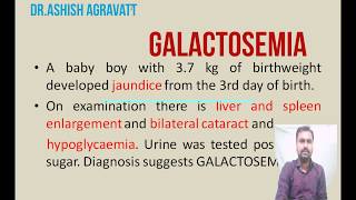 Galactosemia  Galactose metabolism  Biochemistry [upl. by Ced]