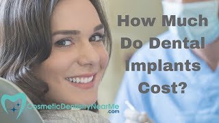 How Much Do Dental Implants Cost [upl. by Allit643]