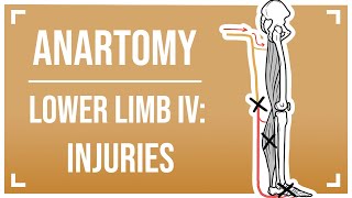 Nerves of the Lower Limb IV Injuries [upl. by Eocsor]