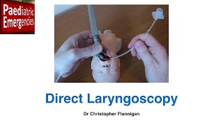 Direct Laryngoscopy [upl. by Asenej]