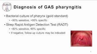 GAS pharyngitis Diagnosis and Treatment [upl. by Eriam]