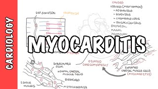 Myocarditis  causes pathophysiology investigation and treatment [upl. by Eilhsa]