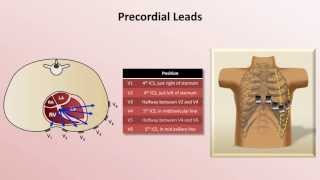 Intro to EKG Interpretation  EKG Leads [upl. by Arak]