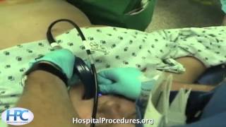 Glidescope Intubation Video [upl. by Hubsher632]