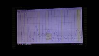 160m Endfed Antenna DIY [upl. by Angel800]