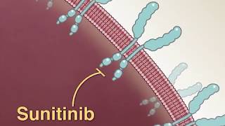 Treating Advanced RenalCell Carcinoma [upl. by Ahsilef]