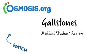 Gallstones  Clinical Presentation [upl. by Haerle328]