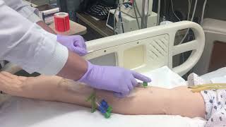 Setting up an intravenous Infusion [upl. by Aicilf]