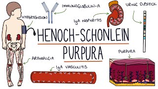 HenochSchonlein Purpura Visual Explanation for Students [upl. by Dominus]