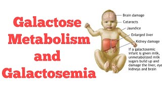 Galactose metabolism  Biochemistry [upl. by Arias]