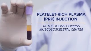 PlateletRich Plasma PRP Injections  QampA [upl. by Eliza]