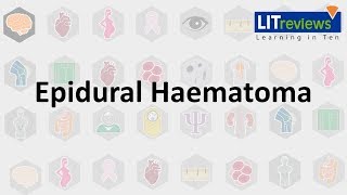 Epidural Haematoma [upl. by Ennovihc]