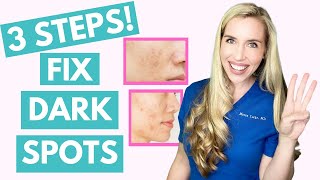 Fix Your Dark Spots in 3 Steps  Hyperpigmentation  Melasma  Skincare Made Simple [upl. by Eolc]