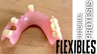 PRÓTESIS DENTAL FLEXIBLES PASO A PASO [upl. by Raine206]