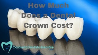 How Much Does a Dental Crown Cost [upl. by Alcinia]