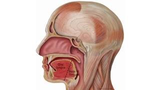 Finding and Removing Tongue Cancer [upl. by Randal]