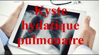 Kyste hydatique pulmonaire [upl. by Hahnert]