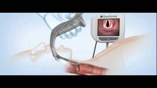 GlideScope Titanium Video Laryngoscopes Demonstration [upl. by Langsdon]