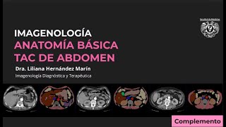 TAC DE ABDOMEN  ANATOMÍA RADIOLÓGICA BÁSICA [upl. by Janine45]