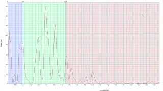 Heart Rate Variability with ADInstruments Labchart for PowerLab [upl. by Leahcimauhsoj467]