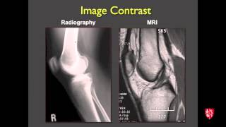 Medical Student Lecture Introduction to Musculoskeletal Imaging [upl. by Neerahs]