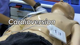 Cardioversion  Defibrillation Technique [upl. by Inanaup]