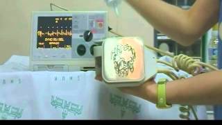 Defibrillator cardioversion [upl. by Gorrian]