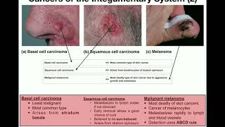 Skin Conditions  Causes Symptoms and Treatment Options [upl. by Femi]