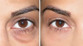 How to Cover Dark Circles  Under Eye Bags [upl. by Savannah687]