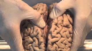 Introduction Neuroanatomy Video Lab  Brain Dissections [upl. by Llennej]