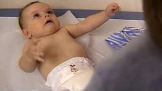 Understanding Infantile Spasms [upl. by Lathan]