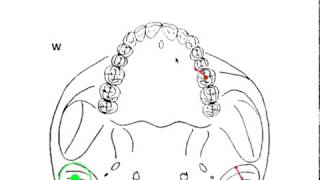 DYNAMIC OCCLUSION  Working vs Nonworking Movement amp Occlusal Grid [upl. by Toshiko635]